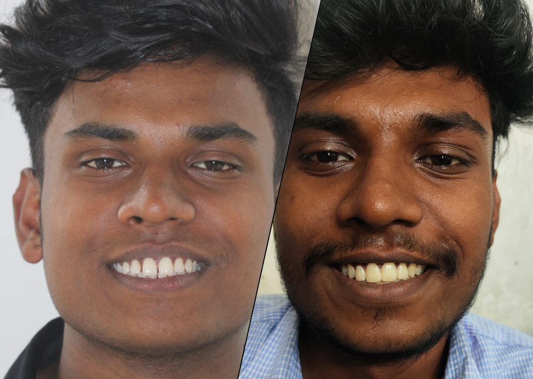 Anandu story